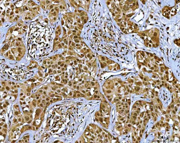  IHC analysis of NR5A2 using anti-NR5A2 antibody (A01332-1)