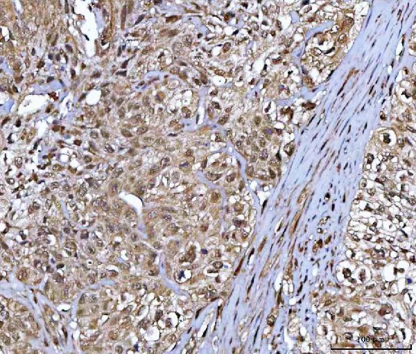  IHC analysis of NR5A2 using anti-NR5A2 antibody (A01332-1)