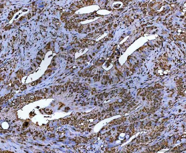 a01332 1 nr5a2 primary antibodies ihc testing 4