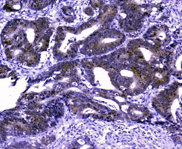  IHC analysis of GOLPH3 using anti-GOLPH3 antibody (A01333-1)
