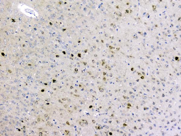  IHC analysis of GOLPH3 using anti-GOLPH3 antibody (A01333-1)
