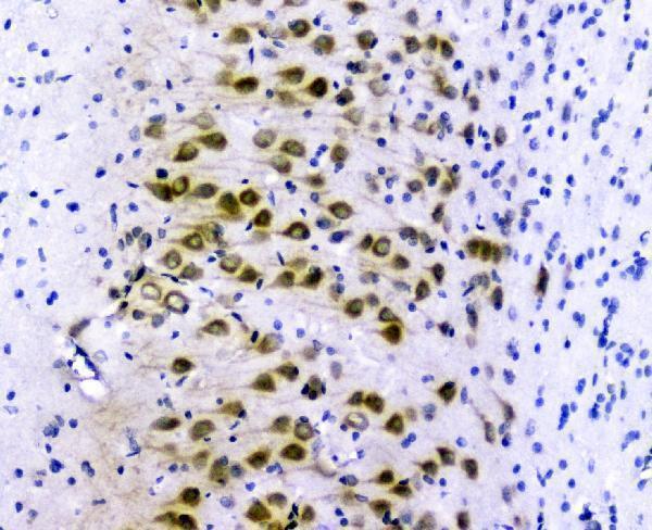 a01333 1 golph3 primary antibodies ihc testing 4