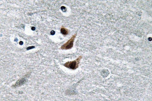 Immunohistochemistry (IHC) analyzes of NM23-H1 (Y52) pAb in paraffin-embedded human brain tissue