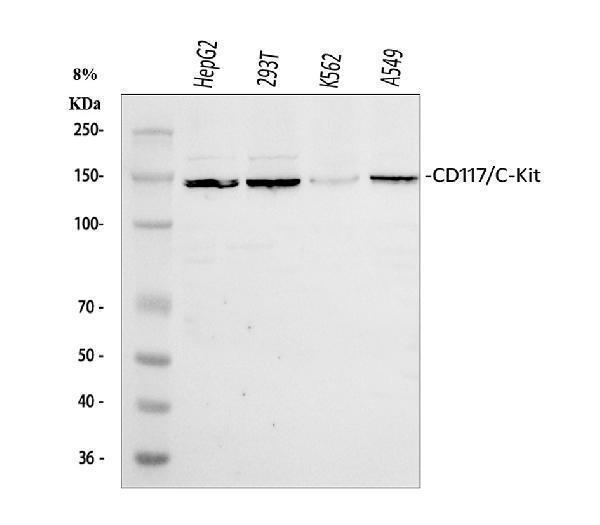  Western blot analysis of Kit using anti-Kit antibody (A01335-1)
