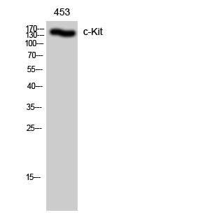 Western Blot analysis of 453 cells using c-Kit Polyclonal Antibody diluted at 1:500