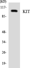 Western blot analysis of the lysates from K562 cells using KIT antibody