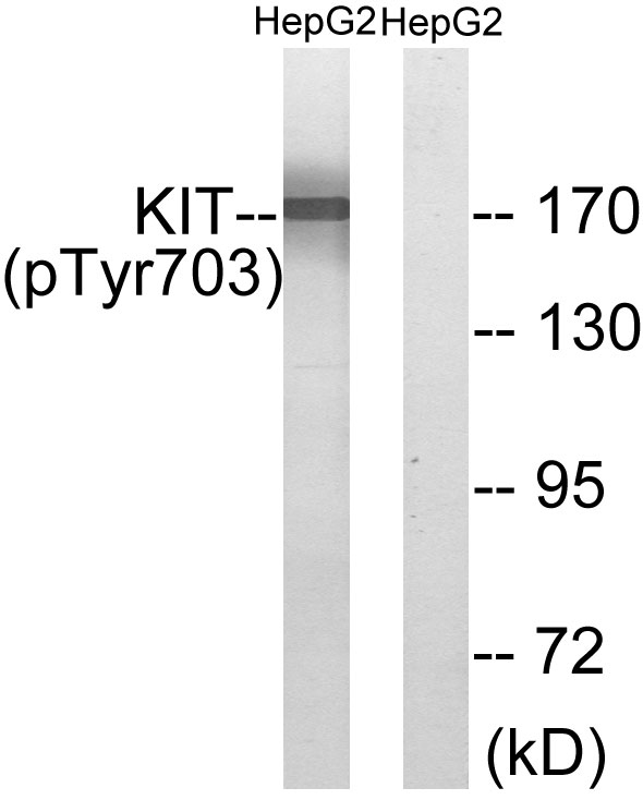 Western blot analysis of lysates from HepG2 cells treated with EGF 200ng/ml 30', using KIT (Phospho-Tyr703) Antibody