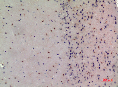 a01337 2 ncoa3 primary antibodyes ihc testing 2