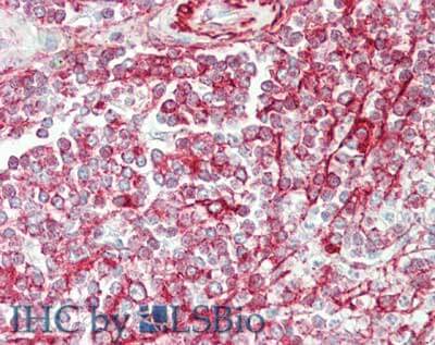 a01337 ncoa3 primary antibodies ihc testing 2_1