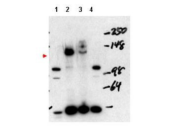 a01337 ncoa3 primary antibodies wb testing 3_1