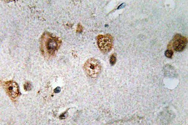 a01337s587 ncoa3 primary antiboties ihc testing 2