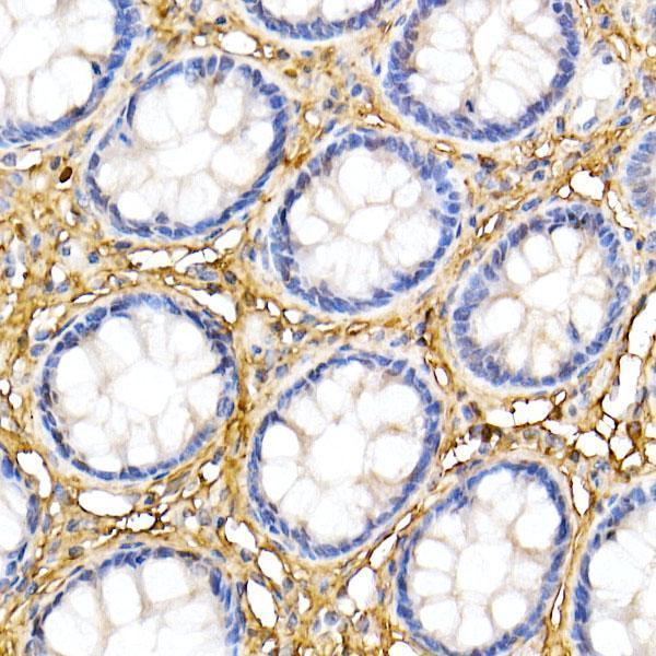 a01339 dcn primary antiboties ihc testing 4