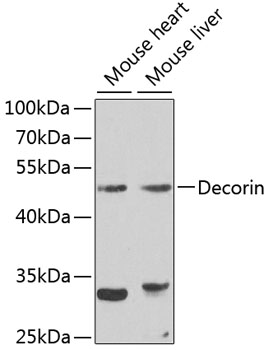 Western blot analysis of extracts of HeLa cells, using Decorin  antibody  at 1:1000 dilution