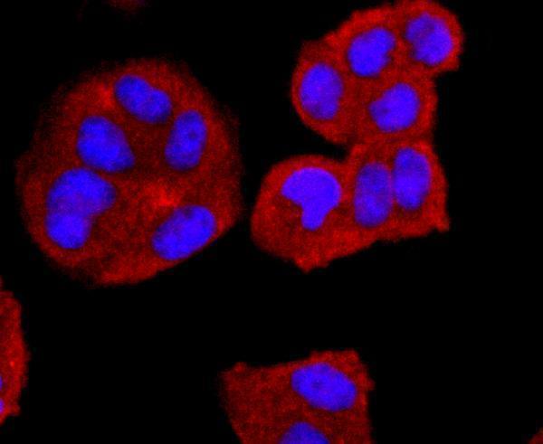 ICC staining CD74 in Hela cells (red)