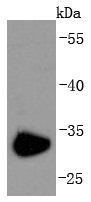 Western blot analysis of CD74 on Raji cells lysates using anti-CD74 antibody at 1/1,000 dilution