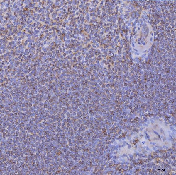  IHC analysis of CD74 using anti-CD74 antibody (A01340-4)