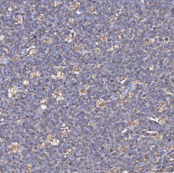  IHC analysis of CD74 using anti-CD74 antibody (A01340-4)