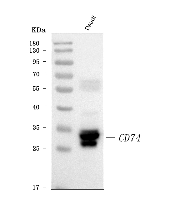  Western blot analysis of CD74 using anti-CD74 antibody (A01340-4)