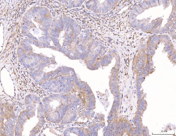  IHC analysis of ENPP1/PC1 using anti-ENPP1/PC1 antibody (A01342-1)