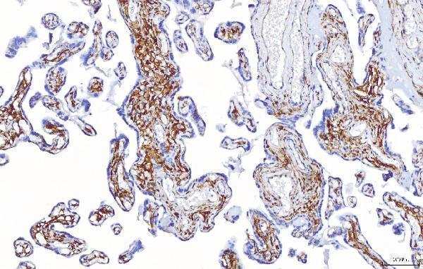 a01342 1 enpp1 primary antibodies ihc testing 4