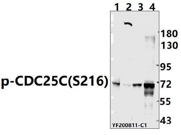 Western blot (WB) analysis of p-CDC25C(S216) pAb at 1:500 dilution
Lane1:PC12 whole cell lysate(40ug)
Lane2:CT-26 whole cell lysate(40ug)
Lane3:Hela whole cell lysate(40ug)
Lane4:HEK293T whole cell lysate(40ug)