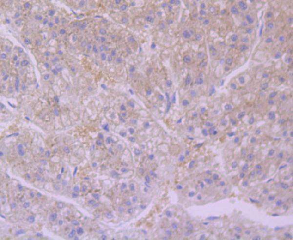 Immunohistochemical analysis of paraffin-embedded human liver tissue using anti-Furin antibody