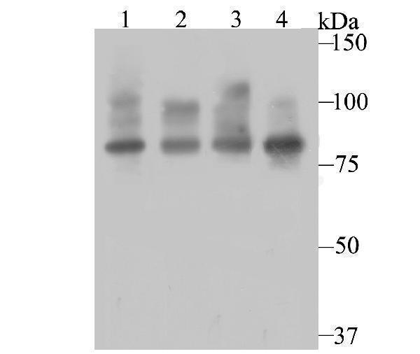 Western blot analysis of Furin on different cell lysates using anti-Furin antibody at 1/500 dilution