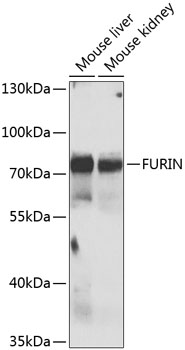 Western blot analysis of extracts of various cell lines, using FURIN antibody