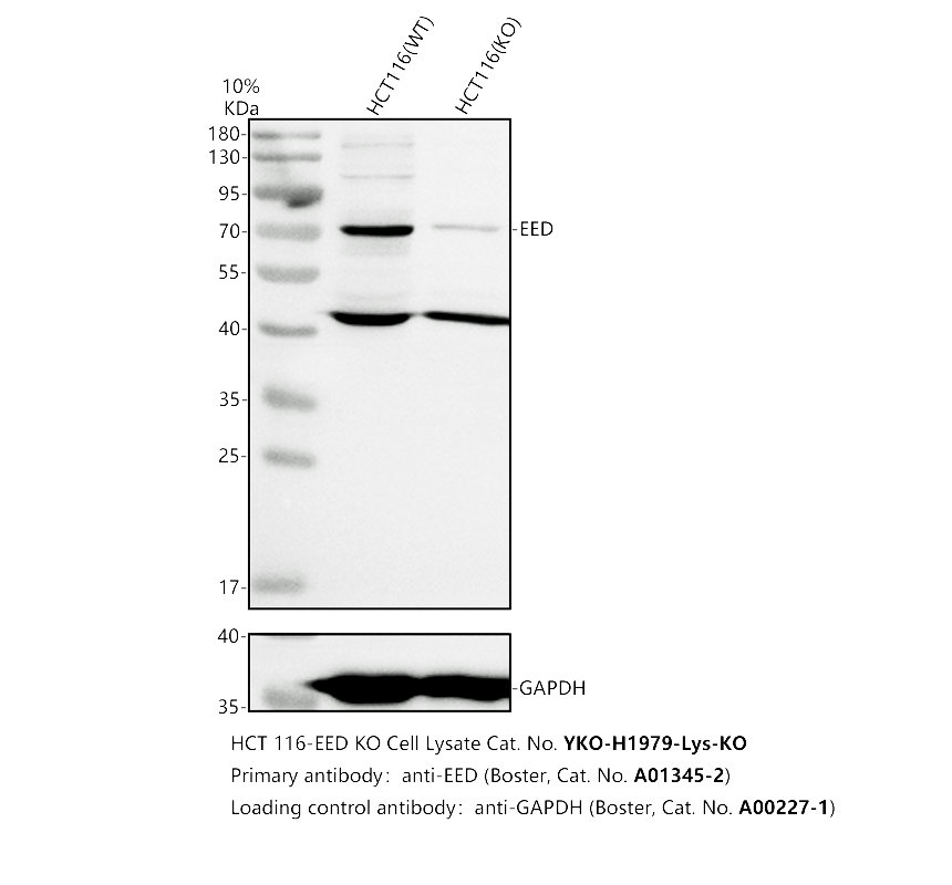 Western blot analysis of EED using anti-EED antibody (A01345-2)