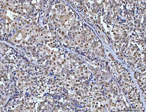  IHC analysis of CHD8 using anti-CHD8 antibody (A01346-1)