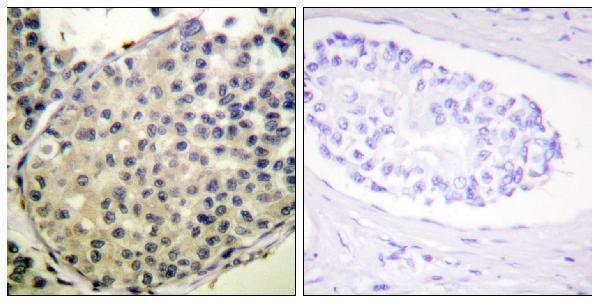 a01351s1148 2 eif4g1 primary antibodies ihc testing 2