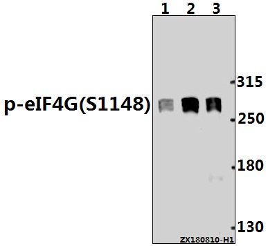 Western blot (WB) analysis of EIF4G1 (phospho-S1148) polyclonal antibody at 1:500 dilution
Lane1:HEK293T whole cell lysate(40ug)
Lane2:HepG2 whole cell lysate(40ug)
Lane3:MCF-7 whole cell lysate(30ug)