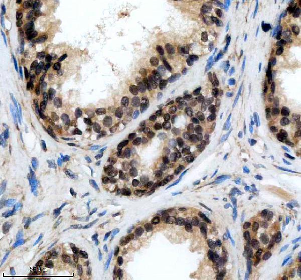 a01352 1 1 lats2 primary antibodies ihc testing 1