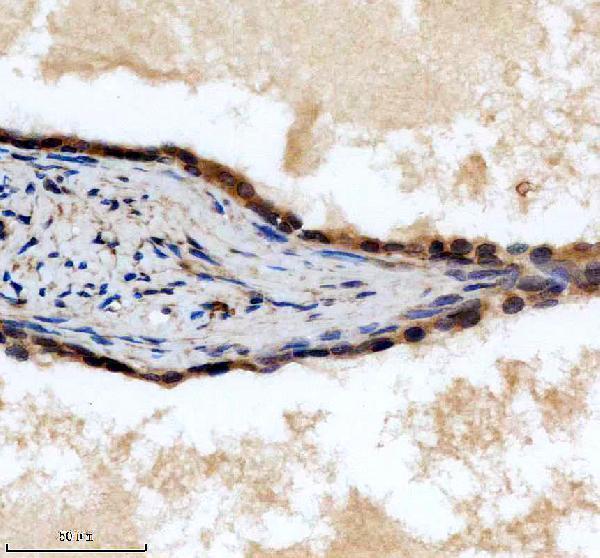 a01352 1 1 lats2 primary antibodies ihc testing 2