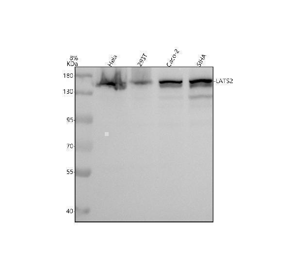 a01352 1 1 lats2 primary antibodies wb testing 1