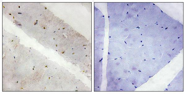 a01352 lats2 primary antibodies ihc testing 2