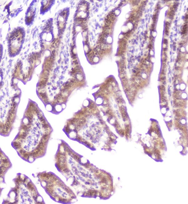 IHC analysis of DDT using anti-DDT antibody (A01354). DDT was detected in paraffin-embedded section of mouse small intestine tissue. Heat mediated antigen retrieval was performed in citrate buffer (pH6, epitope retrieval solution) for 20 mins. The tissue section was blocked with 10% goat serum. The tissue section was then incubated with 2μg/ml rabbit anti-DDT Antibody (A01354) overnight at 4°C. Biotinylated goat anti-rabbit IgG was used as secondary antibody and incubated for 30 minutes at 37°C. The tissue section was developed using Strepavidin-Biotin-Complex (SABC)(Catalog # SA1022) with DAB as the chromogen.