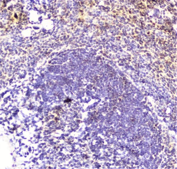 IHC analysis of DDT using anti-DDT antibody (A01354). DDT was detected in paraffin-embedded section of mouse spleen tissue. Heat mediated antigen retrieval was performed in citrate buffer (pH6, epitope retrieval solution) for 20 mins. The tissue section was blocked with 10% goat serum. The tissue section was then incubated with 2μg/ml rabbit anti-DDT Antibody (A01354) overnight at 4°C. Biotinylated goat anti-rabbit IgG was used as secondary antibody and incubated for 30 minutes at 37°C. The tissue section was developed using Strepavidin-Biotin-Complex (SABC)(Catalog # SA1022) with DAB as the chromogen.