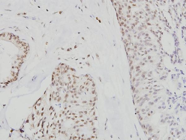 a01355 1 cdc6 primary antiboties ihc testing 2