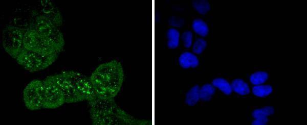 ICC staining Phospho-Cdc6(S54) in Hela cells (green)