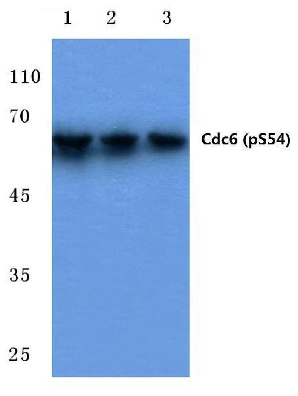 Western blot (WB) analysis of p-Cdc6 (S54) polyclonal antibody at 1:500 dilution
Lane1:Hela cell lysate treated with serum starvation
Lane2:Raw264