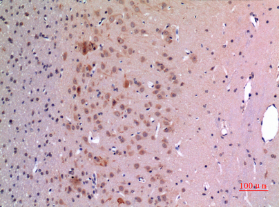 Immunohistochemical analysis of paraffin-embedded rat-brain, antibody was diluted at 1:100