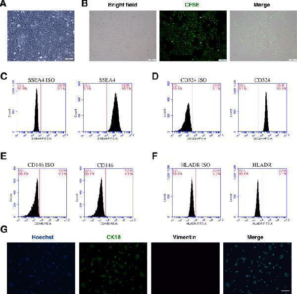 hAECs express specific surface markers and have stem cell characteristics with low immunogenicity
