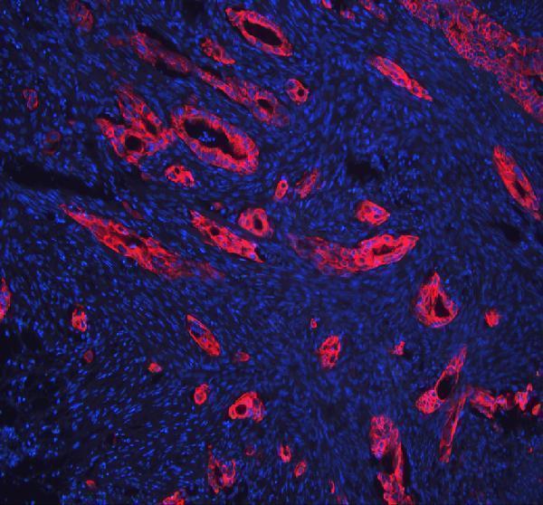 a01357 1 krt18 primary antibodies if testing 1