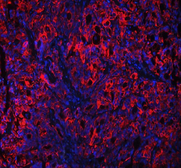 a01357 1 krt18 primary antibodies if testing 2