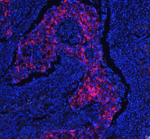 a01357 1 krt18 primary antibodies if testing 3