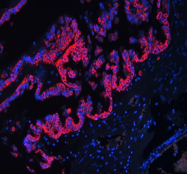 a01357 1 krt18 primary antibodies if testing 5