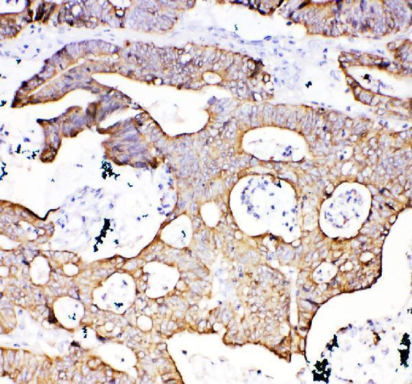a01357 1 krt18 primary antibodies ihc testing 1