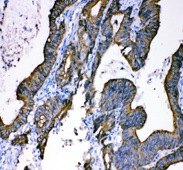 a01357 1 krt18 primary antibodies ihc testing 2