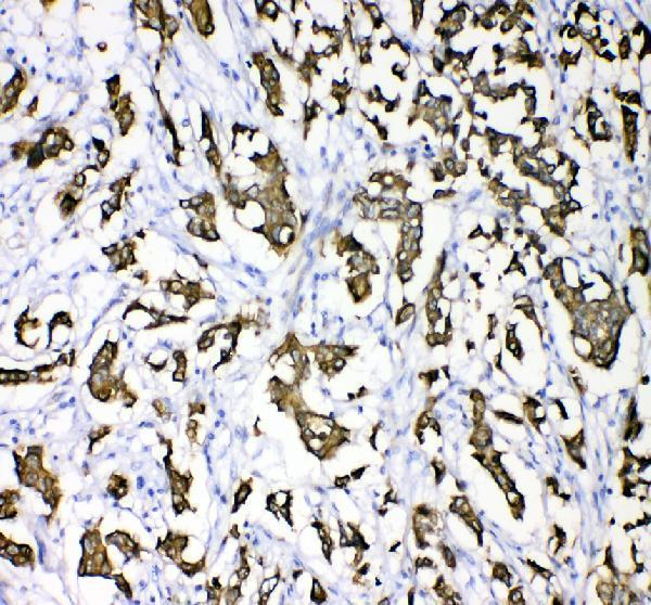 a01357 1 krt18 primary antibodies ihc testing 3